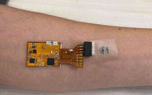 A prototype of the new Israeli tuberculosis-detecting skin patch (courtesy of the Technion-Israel Institute of Technology)